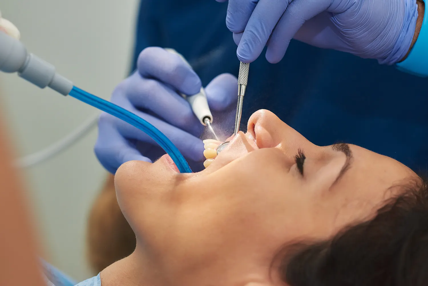 Dental Cleanings in Franklin | Express Dental Studio