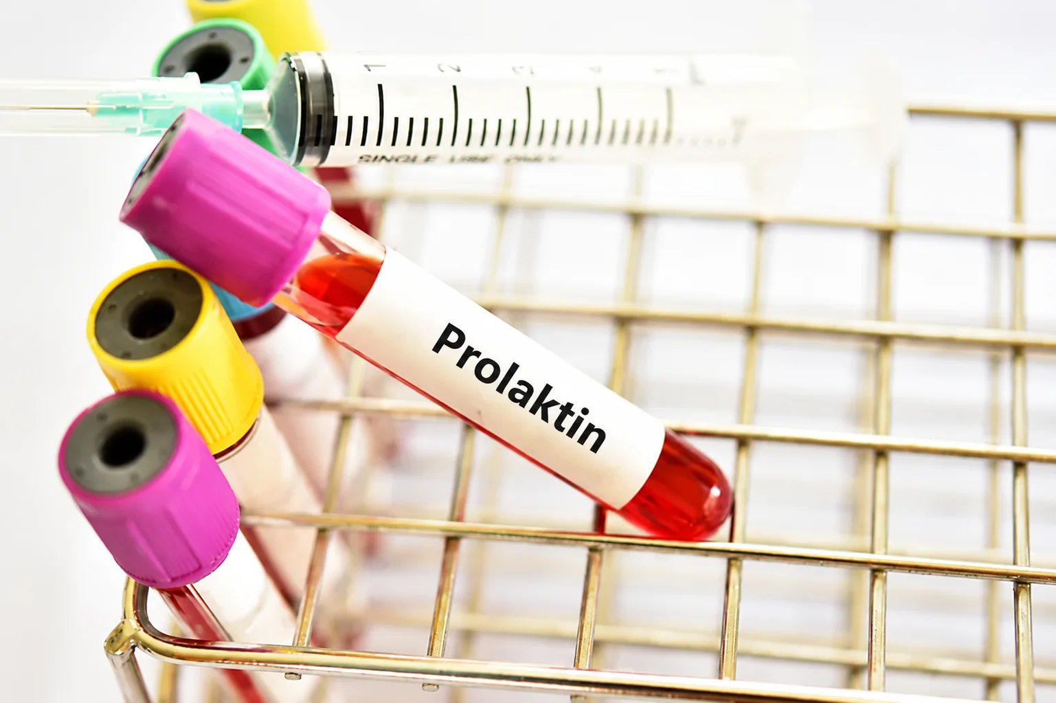 Blutröhrchen mit der Aufschrift „Prolaktin“ liegt in einem Laborgestell neben weiteren Blutproben und einer Spritze. Das Bild steht für die Bestimmung des Prolaktinspiegels durch einen Bluttest.