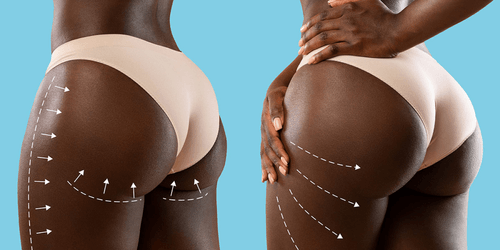 THE RISE OF BBLS: THE INFLUENCE, THE CONSEQUENCES AND THE FUTURE