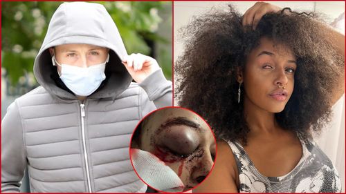 DUBLIN TEEN WHO WAS LEFT BLINDED IN ONE EYE AFTER ATTACK DEEMS SENTENCING 'NOT FAIR'