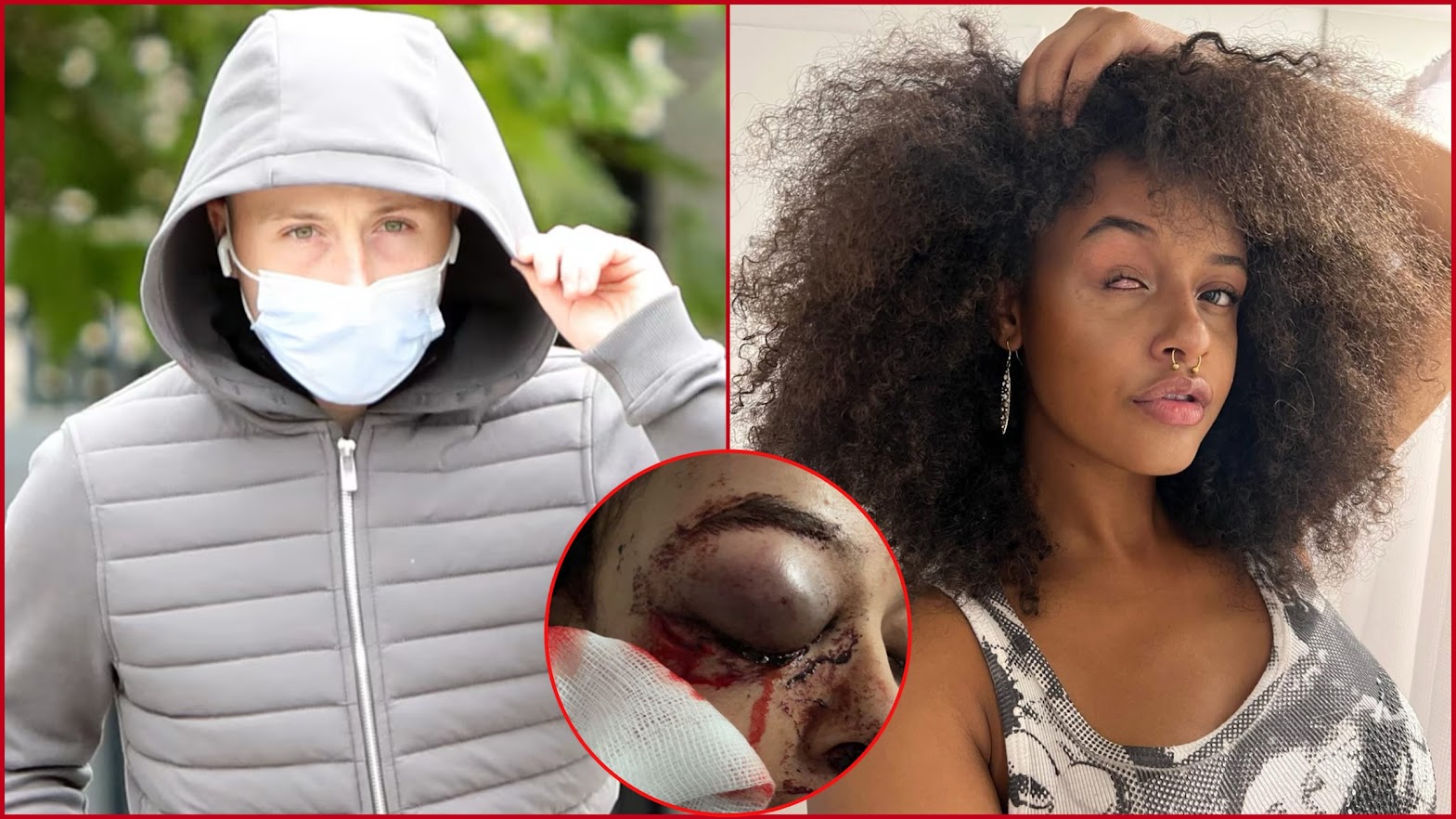 DUBLIN TEEN WHO WAS LEFT BLINDED IN ONE EYE AFTER ATTACK DEEMS SENTENCING 'NOT FAIR'