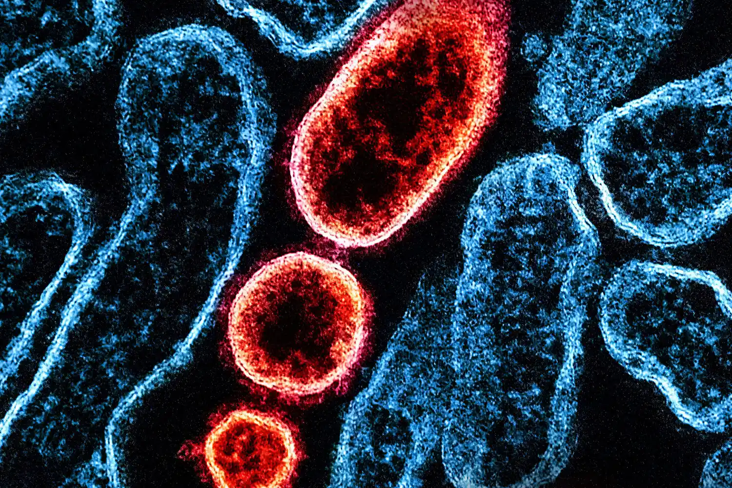 Colorized transmission electron micrograph of mature extracellular Nipah virus particles