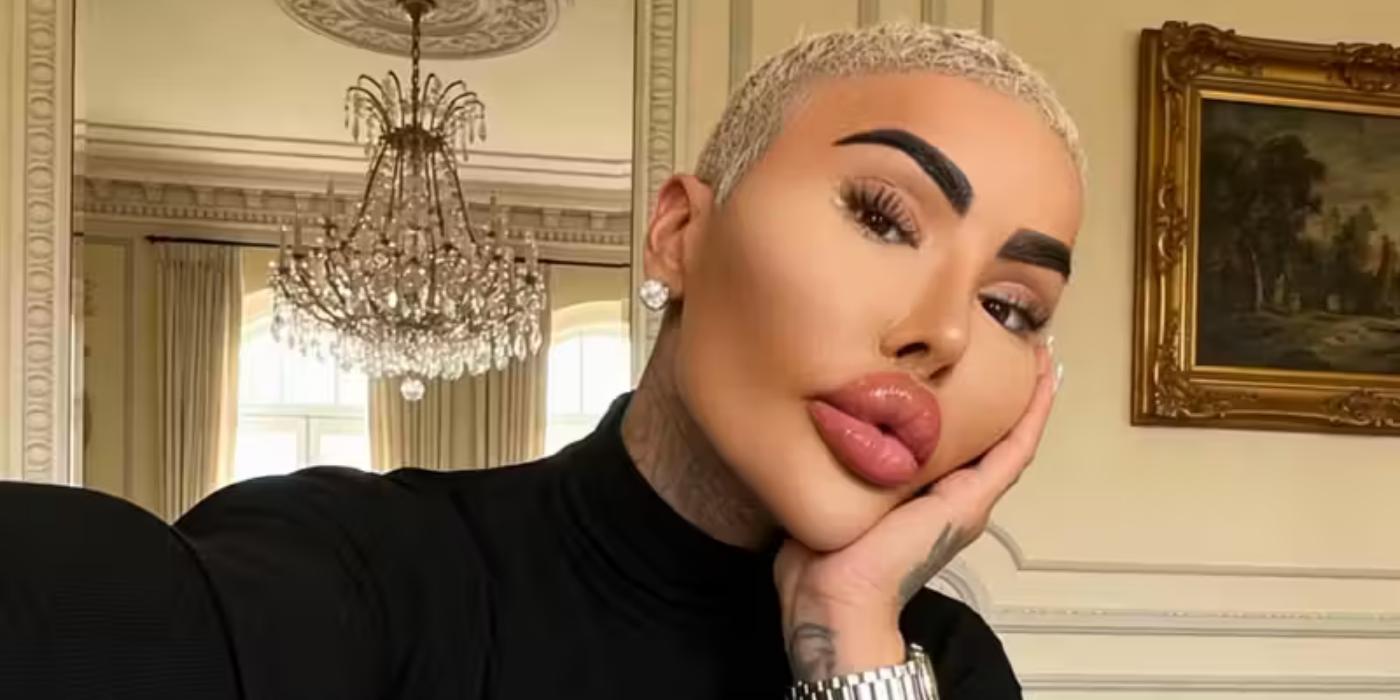 ‘THE LIP KING’ DIES A YEAR AFTER HIS ARREST OVER BBL DEATH