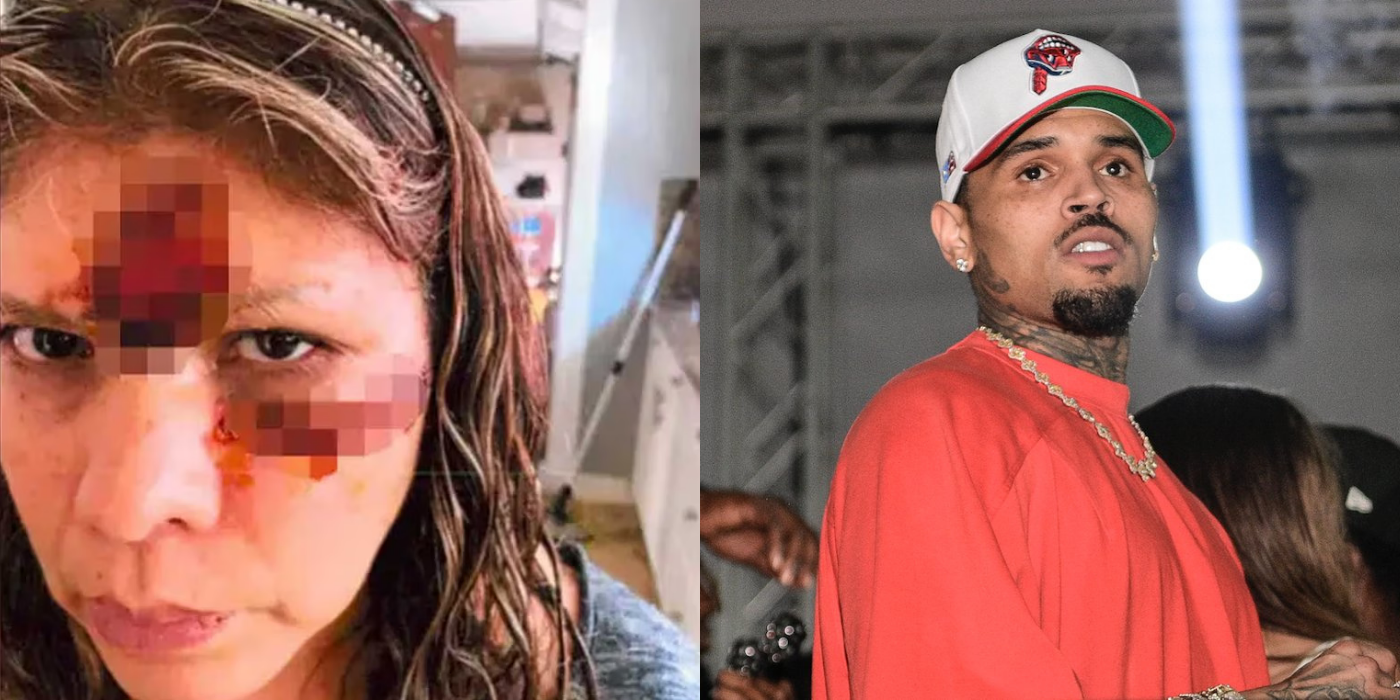 CHRIS BROWN ORDERED TO PAY $13 MILLION TO FORMER HOUSEKEEPER MAULED BY HIS DOG