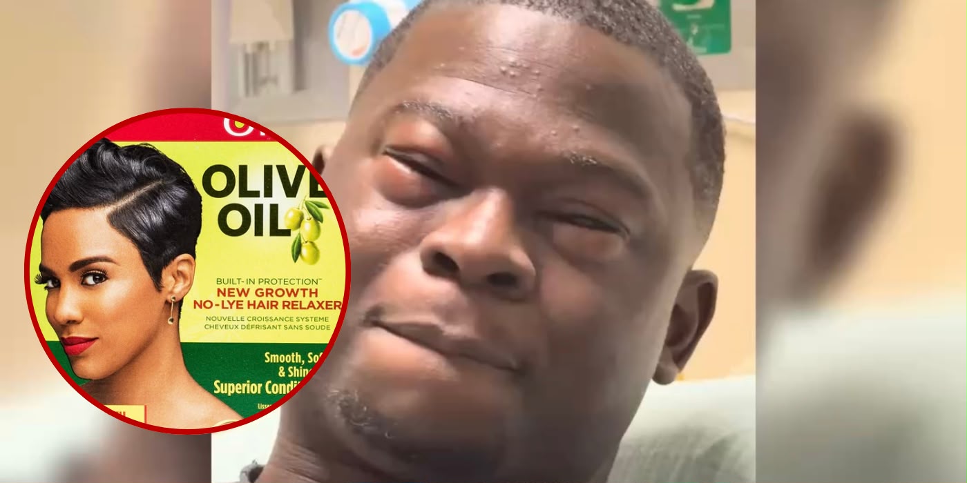 MAN SUFFERS ALLERGIC REACTION AFTER ACCIDENTALLY EATING HAIR RELAXER