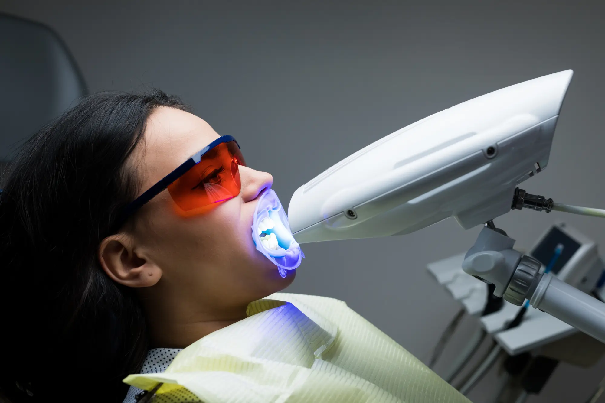 Professional Teeth Whitening: Why In-Office Results Shine Brighter Than At-Home Kits