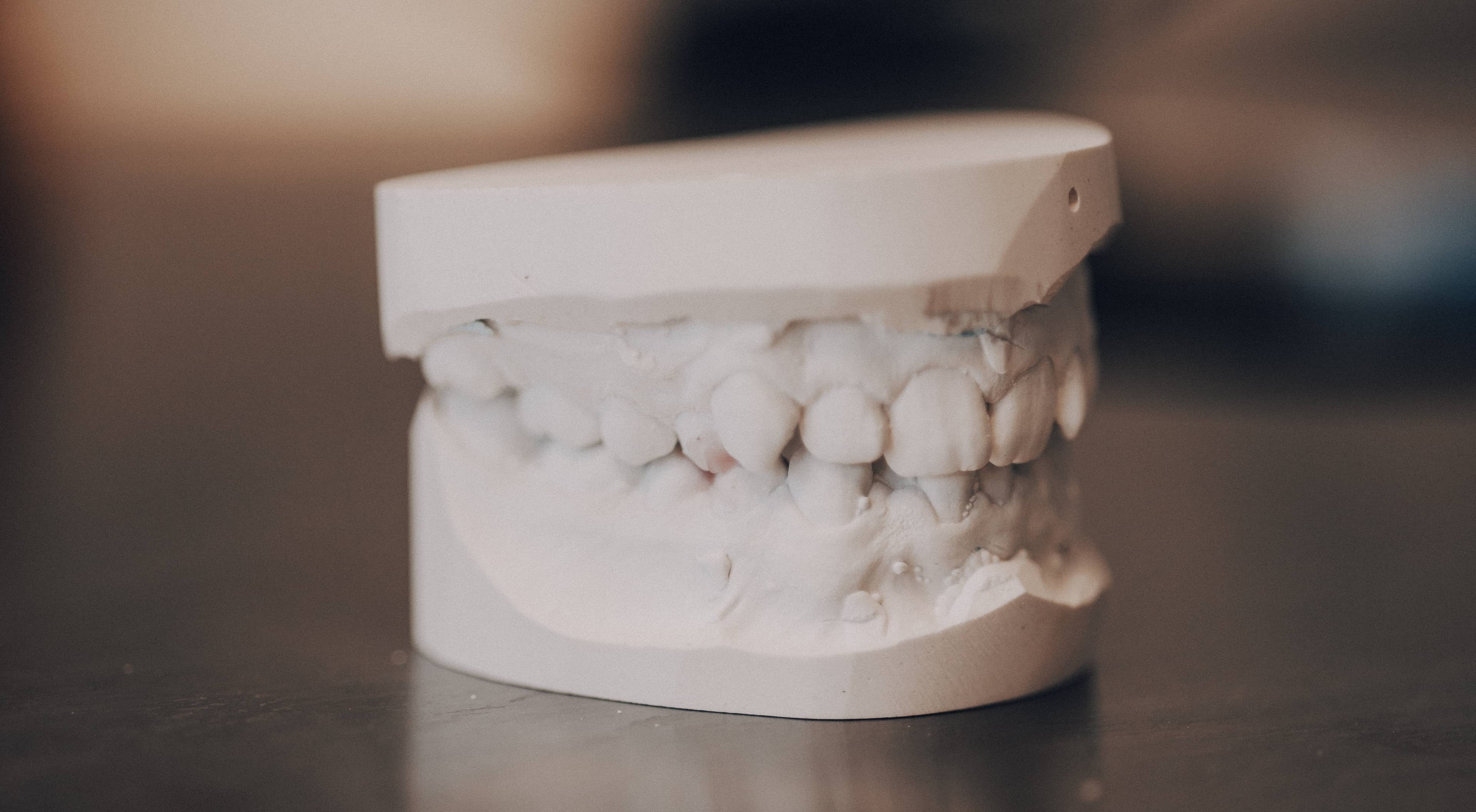 Weißes Gipsmodell des Kiefers auf Labortisch – Zahnabdruck und Modellherstellung Höhn Dentaltechnik