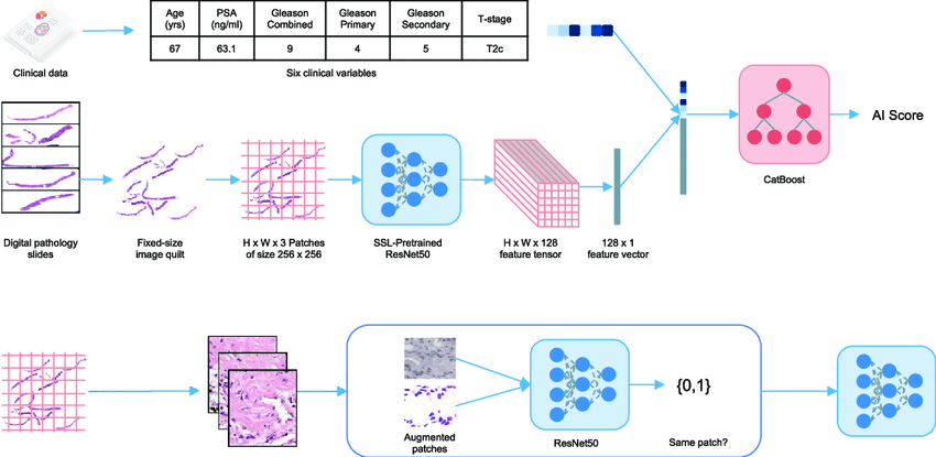 Source : IA Multimodale : Une nouvelle ère pour la médecine de précision L’intelligence artificielle connaît des avancées spectaculaires, et l'IA multimodale se distingue comme une innovation majeure, particulièrement dans le domaine médical. En combinant différentes sources de données, telles que les images médicales, les données cliniques et les analyses biologiques, cette technologie offre une vision intégrée et enrichie des patients. Cette approche permet de surmonter les limites des analyses traditionnelles en exploitant la complémentarité des données pour une compréhension plus fine des pathologies. En plein essor, l’IA multimodale ouvre la voie à une médecine de précision plus efficace, où diagnostics et traitements peuvent être personnalisés avec une précision inégalée. Qu’est-ce que l’IA multimodale ? L’IA multimodale désigne une forme avancée d’intelligence artificielle capable de traiter et d’interpréter plusieurs types de données provenant de sources différentes, souvent hétérogènes. Contrairement aux systèmes traditionnels d’IA qui se concentrent sur un type de données (texte, image, ou audio, par exemple), l’IA multimodale combine des données variées, comme des images médicales, des rapports cliniques, des signaux biologiques ou encore des séquences génétiques. Cette intégration permet une compréhension plus riche et globale de l’information, particulièrement dans des contextes complexes comme la médecine. Comment fonctionne une Intelligence Artificielle Multimodale ? Le fonctionnement de l’IA multimodale repose sur des algorithmes avancés, souvent basés sur des réseaux neuronaux profonds (deep learning), qui sont entraînés à interpréter chaque type de données individuellement tout en apprenant à établir des connexions entre elles. Par exemple, un modèle peut analyser une image IRM pour détecter des anomalies tout en prenant en compte des données cliniques associées, comme les antécédents médicaux du patient ou des résultats biologiques. Grâce à cette capacité à établir des corrélations entre des sources de données distinctes, l’IA multimodale fournit des insights que les approches classiques, limitées à une seule modalité, ne peuvent offrir. Cette technologie repose sur des étapes clés telles que la fusion des données, qui consiste à harmoniser les différentes modalités pour qu’elles soient traitées de manière cohérente, et l’apprentissage multimodal, qui permet au modèle de capitaliser sur la complémentarité des informations. Ainsi, l’IA multimodale offre une approche puissante pour résoudre des problèmes complexes dans des domaines où une compréhension multidimensionnelle est essentielle, comme en médecine de précision. Comment l’IA multimodale améliore-t-elle les diagnostics médicaux ? L’IA multimodale améliore les diagnostics médicaux en exploitant la complémentarité des données provenant de différentes sources, ce qui permet une analyse plus complète et précise des cas cliniques. Contrairement aux méthodes traditionnelles, qui se concentrent souvent sur un seul type de données, comme une image IRM ou un rapport de laboratoire, l’IA multimodale intègre simultanément des informations variées, telles que les données d’imagerie, les dossiers cliniques électroniques, les résultats biologiques et même les antécédents génétiques. Cette approche multidimensionnelle enrichit la prise de décision médicale. Une vue globale pour une précision accrue En combinant des données variées, l’IA multimodale permet de détecter des relations subtiles entre les différents types d’informations. Par exemple, un modèle peut identifier des corrélations entre une anomalie visible sur une image radiologique et des biomarqueurs spécifiques présents dans les résultats sanguins. Cela renforce la précision des diagnostics en réduisant les risques d’erreurs ou d’interprétations isolées. Détection précoce des maladies Grâce à sa capacité à analyser simultanément plusieurs signaux, l’IA multimodale excelle dans la détection précoce des maladies. Par exemple, dans le dépistage des cancers, elle peut combiner des images mammographiques avec des données génétiques pour évaluer plus précisément le risque et proposer une détection rapide, même à un stade asymptomatique. Une personnalisation des soins L’IA multimodale joue un rôle clé dans la médecine de précision, où les traitements sont adaptés à chaque patient en fonction de ses caractéristiques uniques. En intégrant des données cliniques et biologiques spécifiques à un individu, cette technologie peut fournir des recommandations de traitement mieux adaptées et plus efficaces, améliorant ainsi les résultats cliniques. Réduction du temps de diagnostic L’analyse manuelle de grandes quantités de données médicales est souvent chronophage et sujette à des erreurs humaines. L’IA multimodale automatise ces processus tout en maintenant une cohérence dans l’interprétation des données. Cela réduit considérablement le temps nécessaire pour poser un diagnostic, ce qui est particulièrement critique dans les situations d’urgence. En intégrant des données multidimensionnelles et en exploitant leur synergie, l’IA multimodale redéfinit la manière dont les diagnostics médicaux sont réalisés. Elle contribue à une prise de décision plus éclairée, une détection plus rapide des maladies et une personnalisation accrue des traitements, transformant ainsi les soins de santé en profondeur. Quels types de données sont utilisés dans l’IA multimodale en médecine ? L’IA multimodale en médecine s’appuie sur une diversité de données provenant de différentes sources pour offrir une vision complète de l’état de santé d’un patient. Ces données, qui couvrent à la fois des aspects cliniques, biologiques et environnementaux, permettent de croiser les informations pour des analyses approfondies et des diagnostics précis. Voici les principaux types de données utilisés : 1. Données d’imagerie médicale •	Radiographies, IRM et scanner : Permettent de visualiser les structures internes du corps pour identifier des anomalies ou des lésions. •	Imagerie fonctionnelle (comme la tomographie par émission de positrons) : Fournit des informations sur l’activité métabolique des tissus. 2. Données cliniques et démographiques •	Dossiers médicaux électroniques (DME) : Incluent les antécédents médicaux, les diagnostics, les traitements, et les allergies. •	Informations démographiques : Âge, sexe, poids, et d’autres facteurs qui influencent l’état de santé et les risques associés. 3. Résultats biologiques et analyses de laboratoire •	Biomarqueurs : Indicateurs spécifiques, comme les taux de glucose, les lipides ou les enzymes, qui aident à évaluer des pathologies. •	Analyses génétiques : Données issues du séquençage de l’ADN pour identifier des prédispositions génétiques ou des mutations spécifiques. 4. Données textuelles •	Rapports cliniques : Notes rédigées par les médecins décrivant les symptômes, diagnostics, et recommandations. •	Comptes rendus de radiologie ou de pathologie : Résumés des observations médicales issues des examens. 5. Signaux physiologiques •	Données ECG (électrocardiogramme) : Mesurent l’activité électrique du cœur. •	Signaux EEG (électroencéphalogramme) : Enregistrent l’activité électrique cérébrale. •	Données sur les fonctions vitales : Fréquence cardiaque, pression artérielle, saturation en oxygène, etc. 6. Données environnementales et comportementales •	Suivi de l’activité physique : Capté par des dispositifs portables (comme les montres connectées). •	Facteurs environnementaux : Exposition à la pollution, qualité de l’air, et conditions climatiques. 7. Données issues des essais cliniques •	Protocole d’étude : Données détaillant les traitements administrés et leurs effets observés. •	Résultats des tests cliniques : Informations collectées sur des cohortes de patients pour valider des hypothèses médicales. En croisant ces données, l’IA multimodale permet de créer des modèles sophistiqués capables d’identifier des patterns invisibles à l’œil humain et de fournir des recommandations médicales personnalisées. Ce mélange de données hétérogènes est ce qui fait de l’IA multimodale un outil révolutionnaire dans le domaine médical. Quels sont les cas d’usage actuels de l’IA multimodale dans la santé ? L’IA multimodale transforme actuellement le domaine de la santé en s’attaquant à des problèmes complexes nécessitant l’analyse de données provenant de plusieurs sources. Voici les principaux cas d’usage actuels qui montrent son potentiel dans la pratique médicale : 1. Diagnostic des maladies complexes •	Cancer : L’IA multimodale combine des images radiologiques, des biopsies, et des analyses génétiques pour détecter des cancers à un stade précoce ou évaluer leur progression. •	Maladies cardiaques : Les données d’imagerie (échographies cardiaques), les électrocardiogrammes (ECG), et les antécédents cliniques permettent d’identifier les risques cardiovasculaires avec une précision accrue. 2. Médecine de précision En croisant les données génomiques, cliniques et biologiques, l’IA multimodale aide à personnaliser les traitements en fonction des caractéristiques spécifiques du patient. Par exemple, elle peut recommander un traitement médicamenteux basé sur le profil génétique et l’historique médical du patient. 3. Gestion des maladies chroniques •	Diabète : Les modèles multimodaux analysent les données de suivi des glycémies, les habitudes alimentaires et les niveaux d’activité physique pour aider les patients à mieux gérer leur condition. •	Asthme : Les capteurs environnementaux combinés aux données cliniques permettent d’anticiper les crises en identifiant les déclencheurs. 4. Aide à la chirurgie assistée Les systèmes d’IA multimodale fournissent des outils aux chirurgiens en combinant des images préopératoires (IRM, scanner) avec des données en temps réel issues de capteurs. Cela améliore la précision des interventions chirurgicales, notamment pour des opérations complexes comme celles du cerveau ou du cœur. 5. Recherche clinique et essais thérapeutiques L’IA multimodale est utilisée pour analyser des cohortes de patients en intégrant des données hétérogènes issues des essais cliniques, ce qui permet de découvrir des biomarqueurs ou d’identifier des populations cibles pour de nouveaux traitements. 6. Détection précoce des épidémies En combinant des données cliniques, démographiques, et environnementales, l’IA multimodale peut anticiper les épidémies en identifiant des clusters de symptômes dans des régions spécifiques. 7. Analyse des pathologies rares Les pathologies rares nécessitent souvent une analyse combinée de données très diverses. L’IA multimodale aide à réduire le temps de diagnostic en croisant les données génétiques, les imageries spécifiques, et les antécédents médicaux. 8. Suivi post-traitement et réadaptation Les données issues de dispositifs connectés, couplées à des dossiers médicaux, permettent de suivre les progrès des patients après un traitement ou une intervention chirurgicale. Cela favorise une réhabilitation personnalisée. 9. Formation et aide à la décision pour les professionnels de santé Les modèles d’IA multimodale servent d’outils éducatifs pour former les praticiens, en simulant des cas complexes où différentes modalités doivent être interprétées simultanément. 10. Prévention et prédiction des risques Les plateformes multimodales analysent les antécédents médicaux, les habitudes de vie, et les facteurs environnementaux pour prédire les risques de maladies comme le diabète ou les maladies cardiaques, permettant des interventions préventives ciblées. Ces cas d’usage montrent que l’IA multimodale, en combinant des sources de données variées, ouvre des perspectives inédites dans la santé. Elle améliore non seulement le diagnostic et le traitement, mais également la prévention et la gestion des maladies. Conclusion L’IA multimodale représente une avancée significative dans le domaine médical, permettant d’intégrer et d’exploiter des données variées pour transformer la manière dont les soins de santé sont dispensés. En combinant l’analyse des images, des données cliniques, et des signaux biologiques, cette technologie ouvre la voie à des diagnostics plus précis, des traitements personnalisés et une médecine véritablement de précision. Cependant, malgré ses promesses, l’IA multimodale soulève des défis, notamment en termes d’éthique, de gestion des données et d’interopérabilité des systèmes. En surmontant ces obstacles, elle pourrait devenir un pilier essentiel de la santé connectée et révolutionner les pratiques médicales, offrant ainsi des perspectives inédites pour les patients et les professionnels de santé.