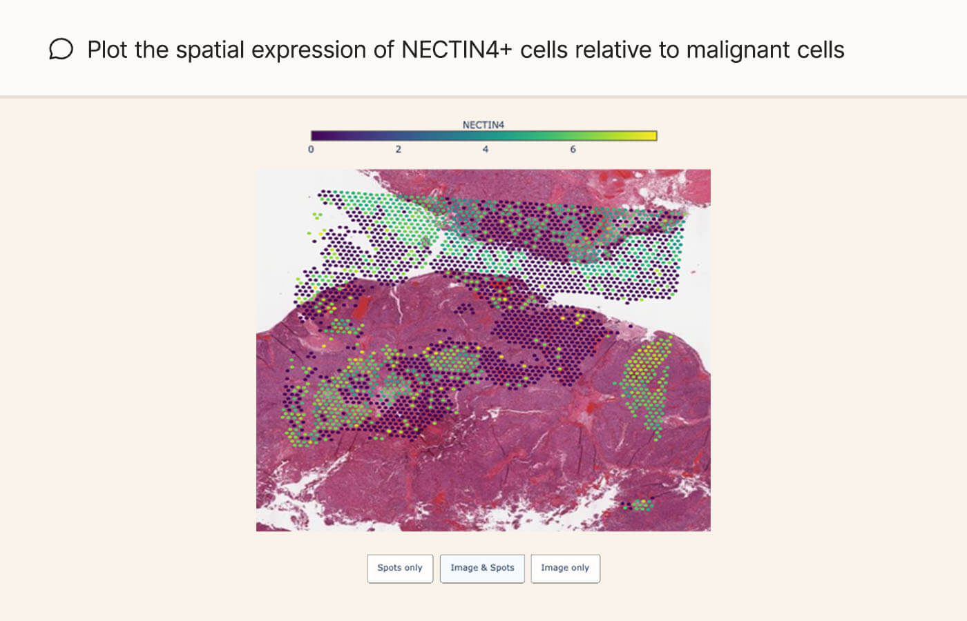 Plot the spatial expression of NECTIN4+ cells relative to malignant cells.
