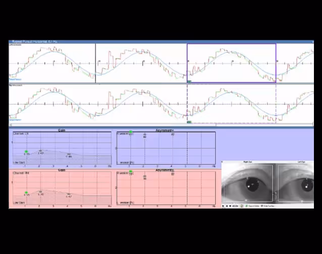 Computer-based tests that challenge fine motor control over purposeful eye movements give us important information about how specific parts of the brain work. Including parts of the brain involved in the coordination and processing of different sensory inputs, coordination, concentration and motor skills.