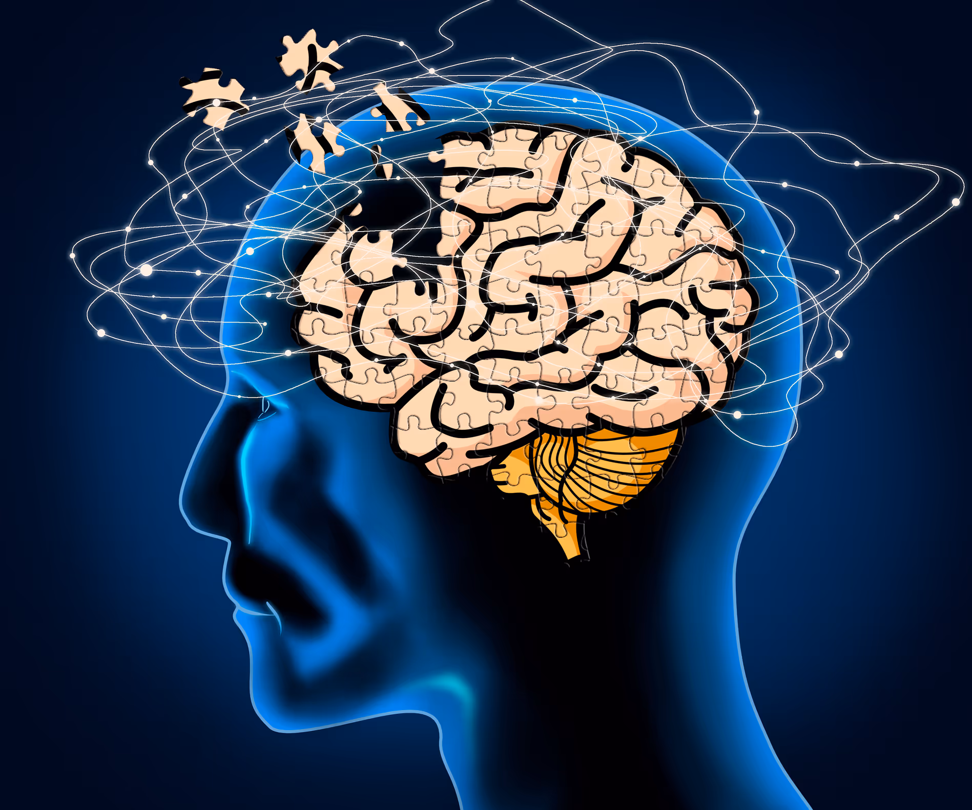 Concussion - What happens to the brain?  PART 2