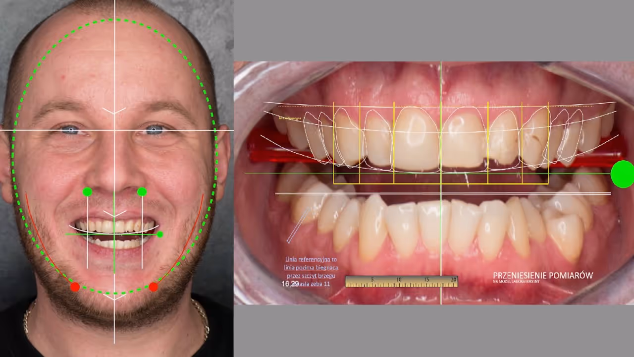 DIGITAL SMILE DESIGN - YouTube