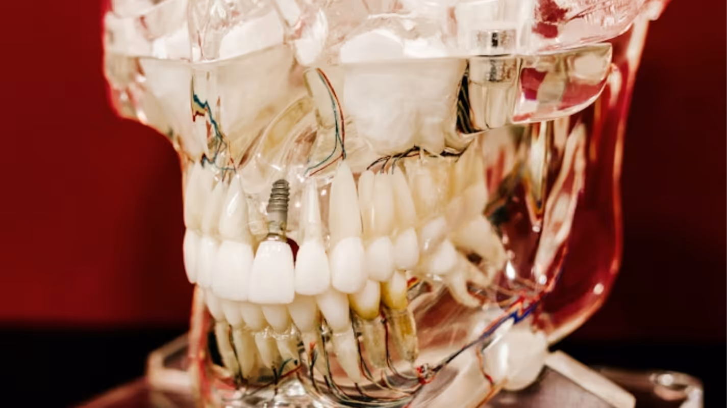 Implanty zębów – kompletny przewodnik przed zabiegiem implantacji w Słupsku