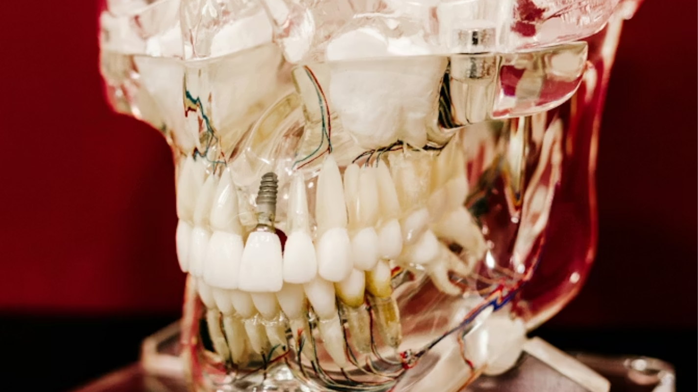 Implanty zębów – kompletny przewodnik przed zabiegiem implantacji w Słupsku