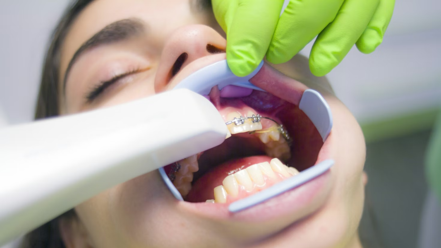 Cyfrowe projektowanie uśmiechu (DSD) – zobacz swój nowy uśmiech jeszcze przed leczeniem