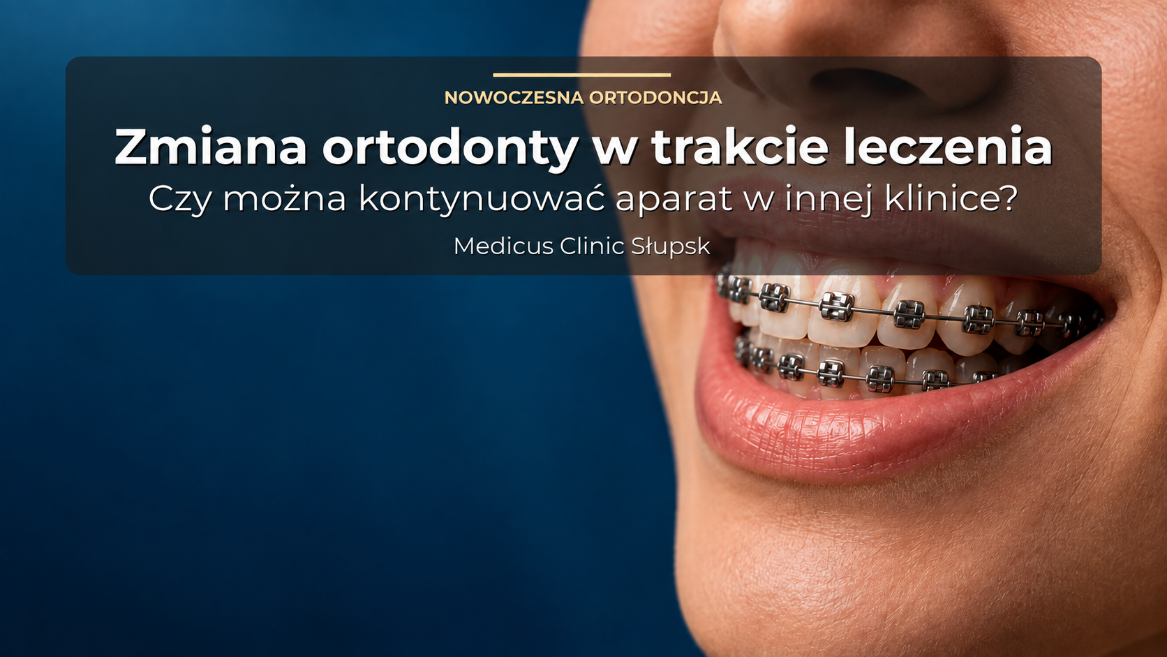 Zmiana ortodonty w trakcie leczenia – czy można kontynuować aparat w innej klinice?