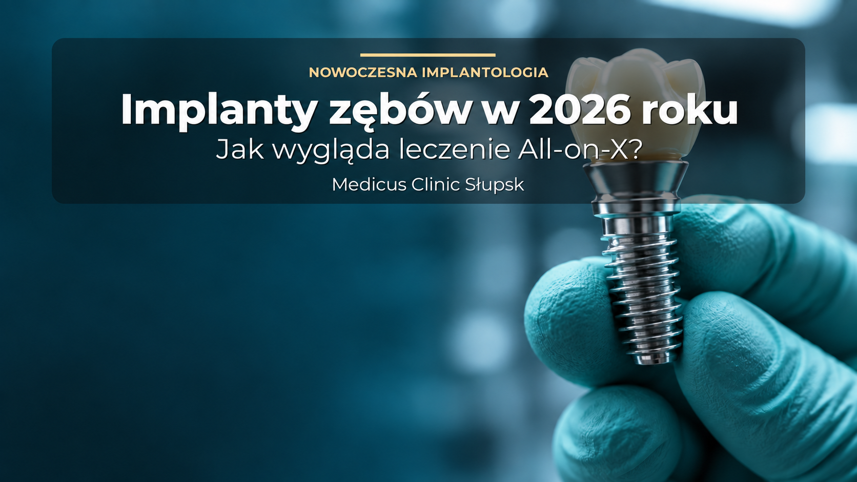 Implanty zębów w 2026 roku – jak wygląda nowoczesne leczenie i czym jest All-on-X?