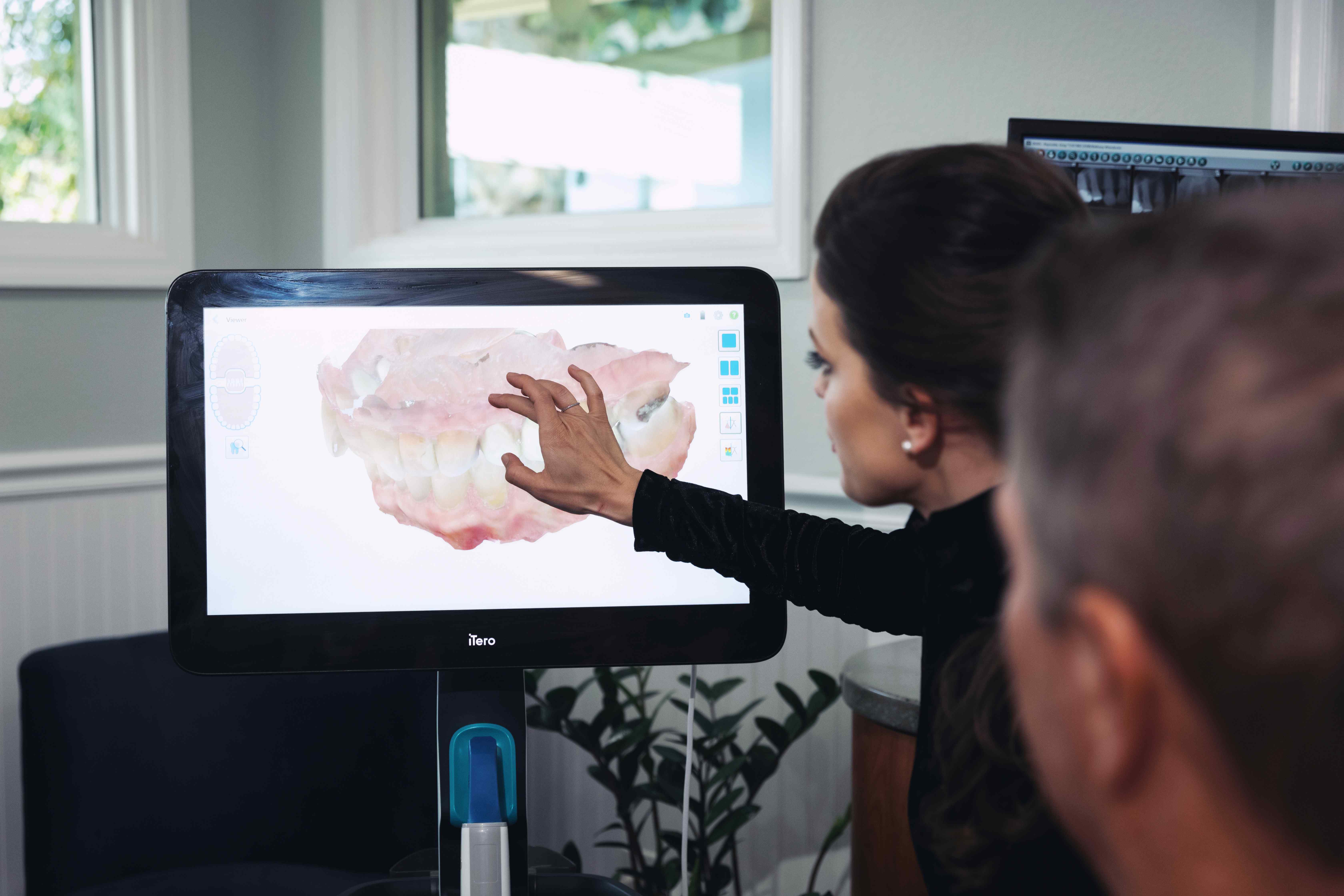 Our specialists at Aesthetic Dentistry of Stuart, explaining candidacy for Full-Mouth Rehabilitation to a client