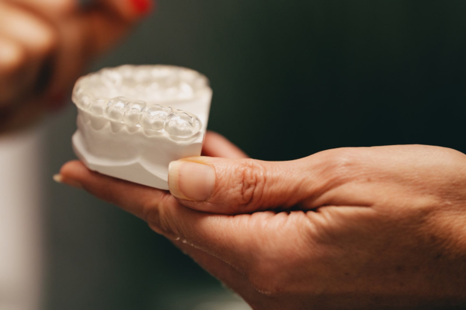 Hands holding clear orthodontic aligner tray for dental treatment