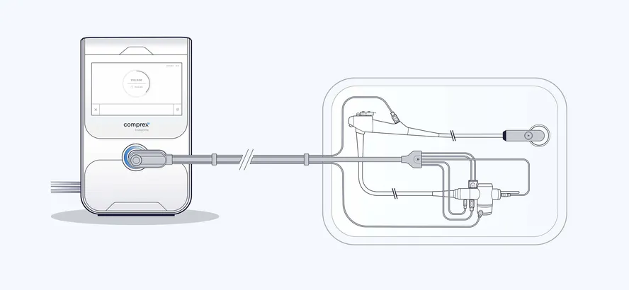 Illustration der Vorreinigung