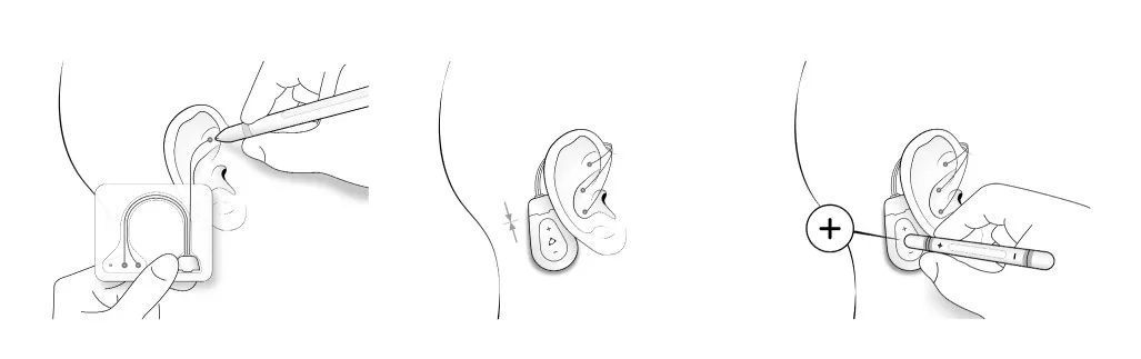 VIVO stimulator - application illustration