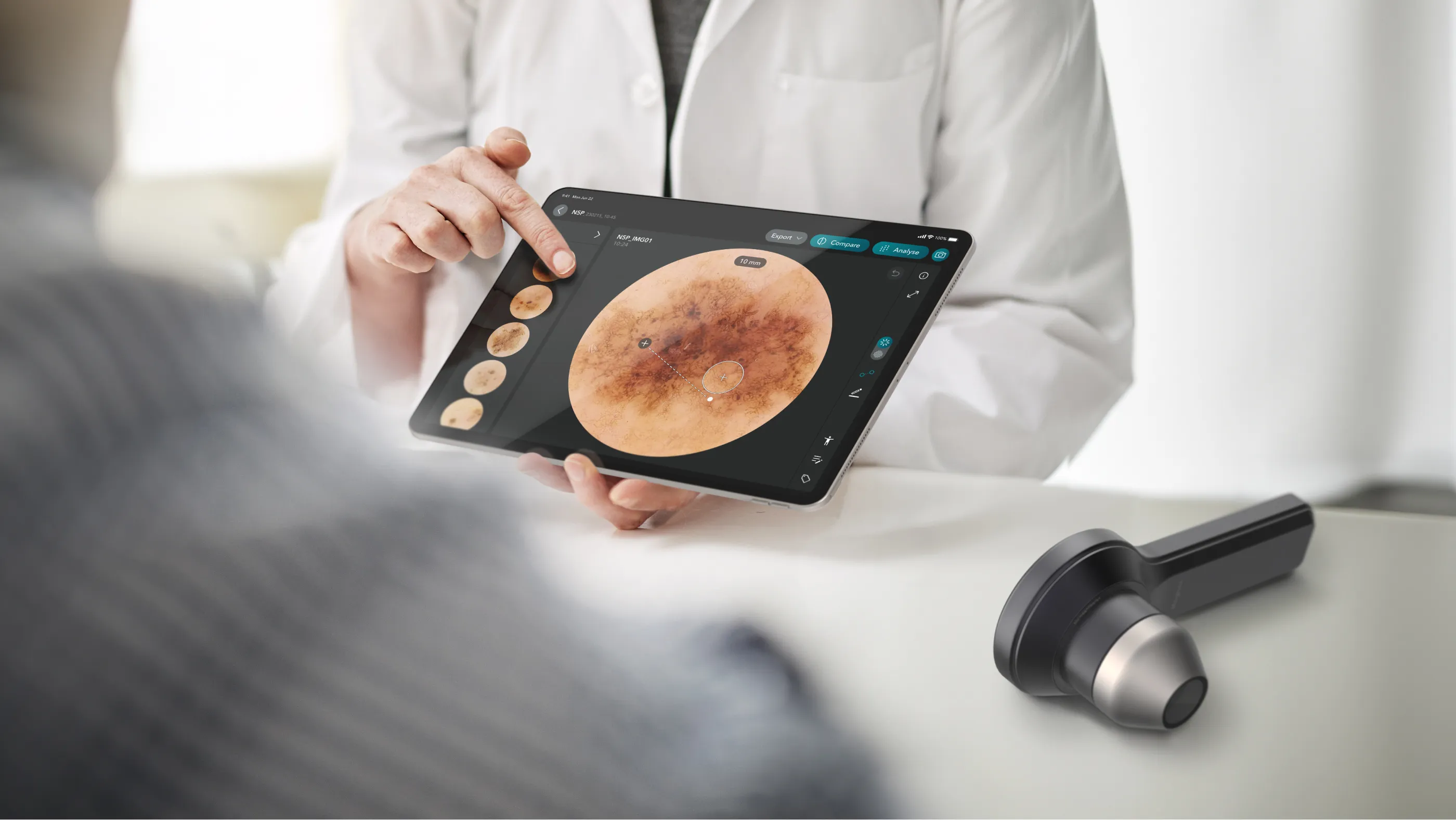 Magnos – Ein KI-unterstütztes digitales Dermatoskopie-System