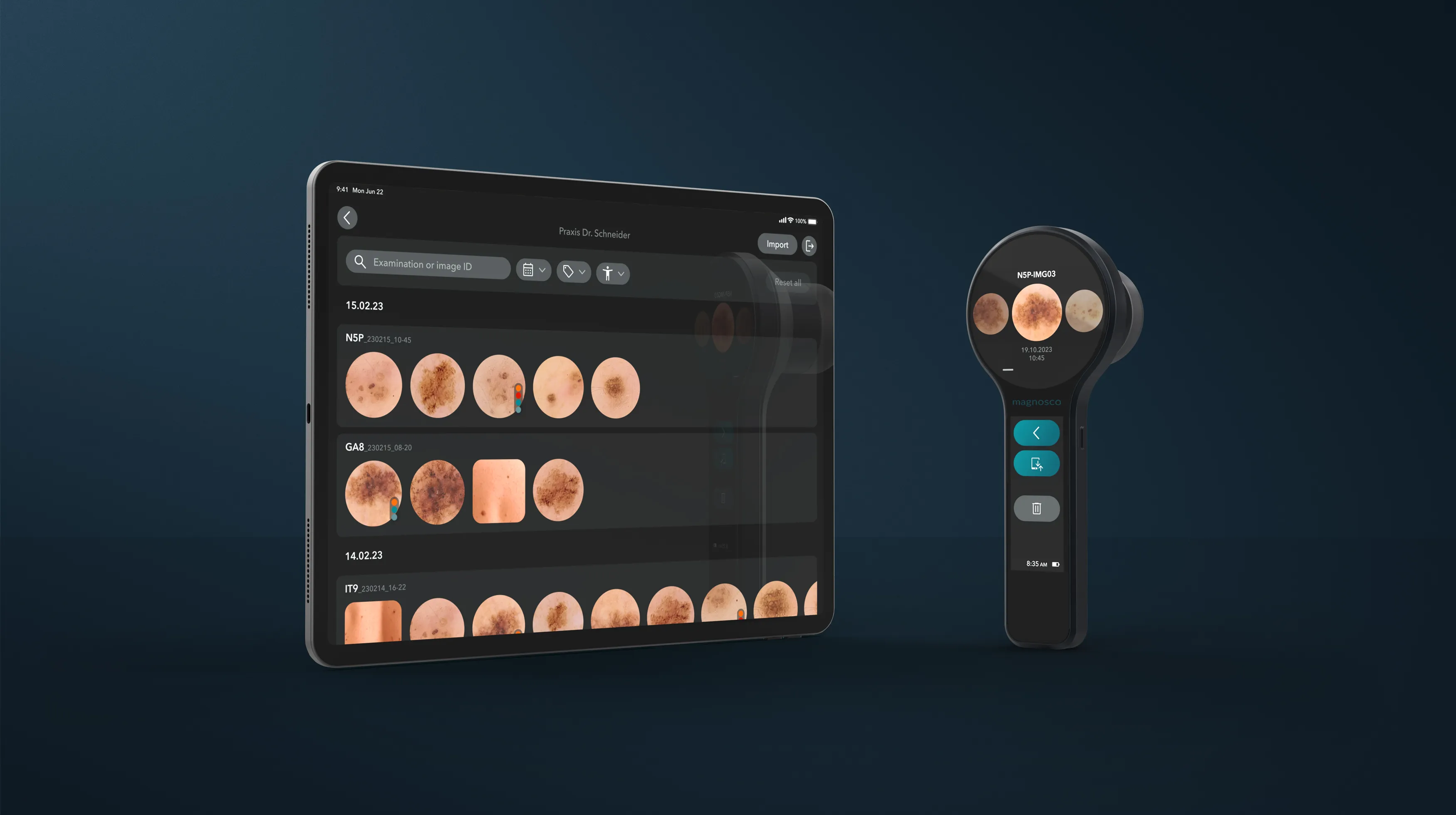 Innovatives System zur Reduktion unnötiger Biopsien