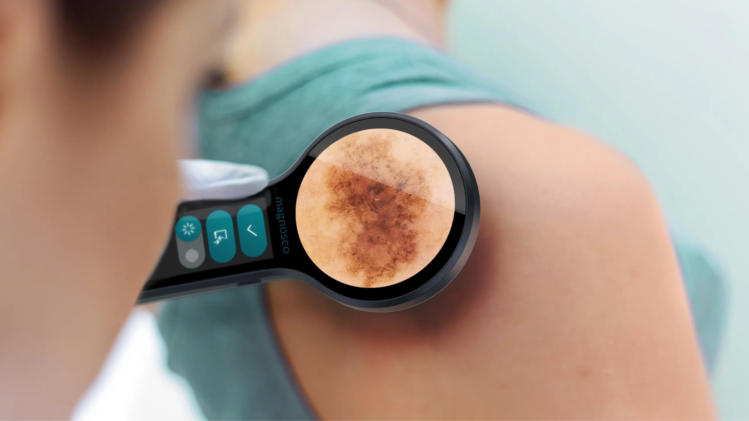 Innovatives System zur Reduktion unnötiger Biopsien