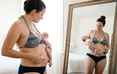 Will a Tummy Tuck Fix Diastasis Recti and Make My Core Stronger?