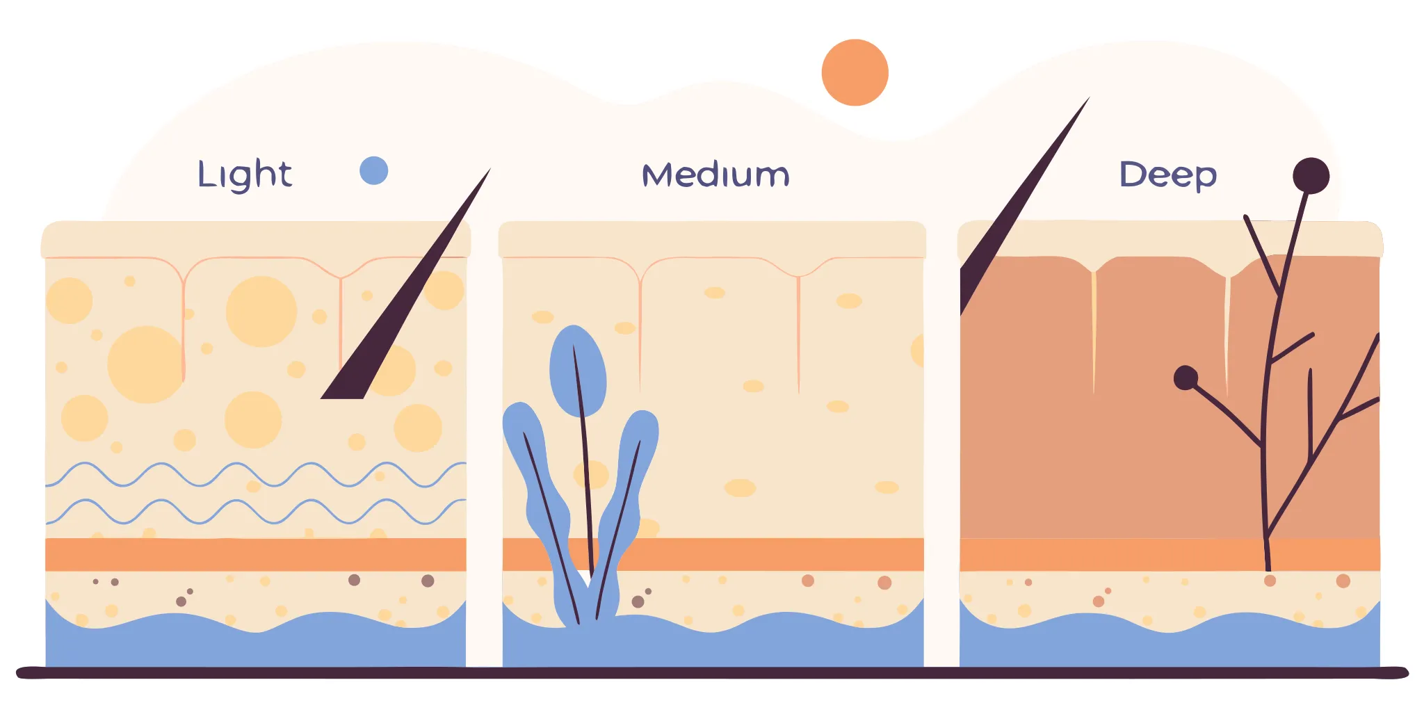 Illustration comparing recovery needs by chemical peel depth