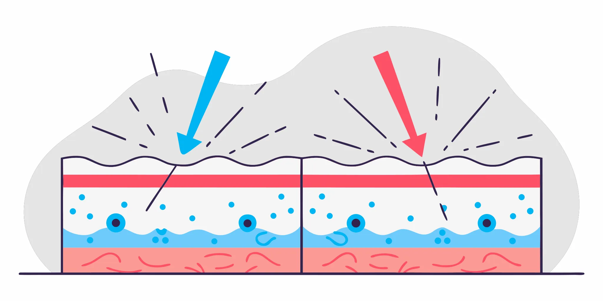 Flat vector illustration of laser light breaking tattoo ink particles in skin layers