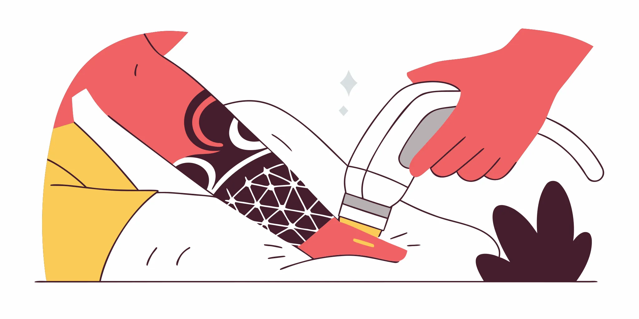 Laser hair removal on a leg, carefully avoiding the tattooed skin.