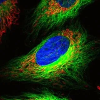 Illustration of microscopic analysis by the Fluosphera team