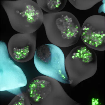 Microtissue spheroids with green fluorescent puncta, some highlighted in cyan