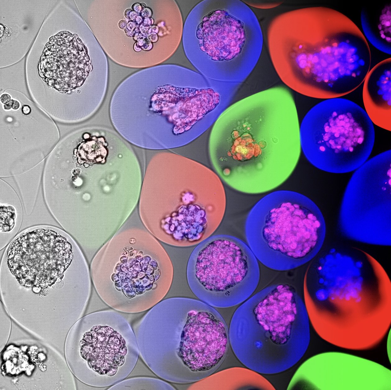 Human 3D multi-tissue system: encapsulated tumor, liver and healthy tissue microtissues imaged side by side