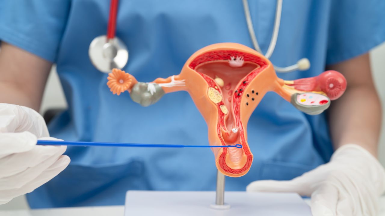 a nurse showing one uterus 