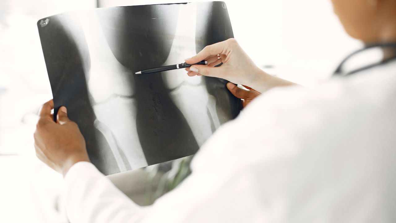 a doctor watching a radiography
