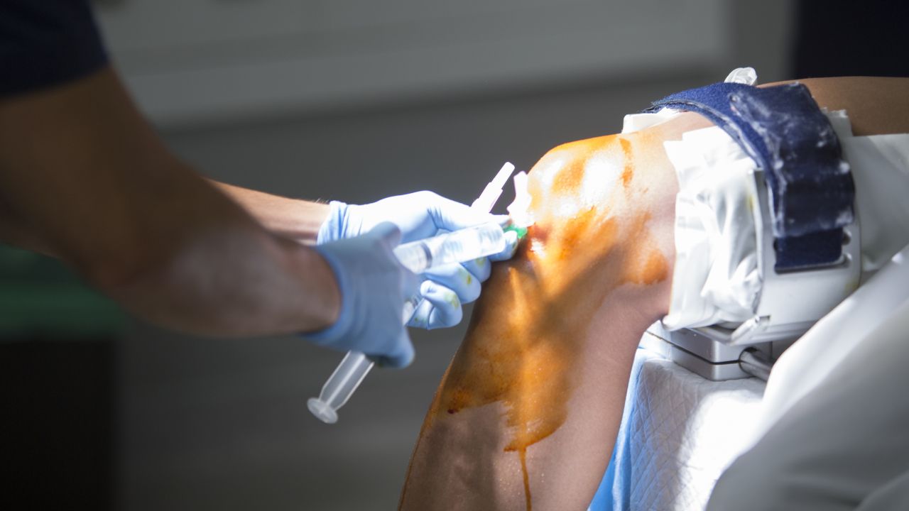 a nurse checking a knee