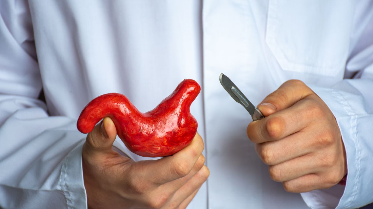 a doctor showing a stomach