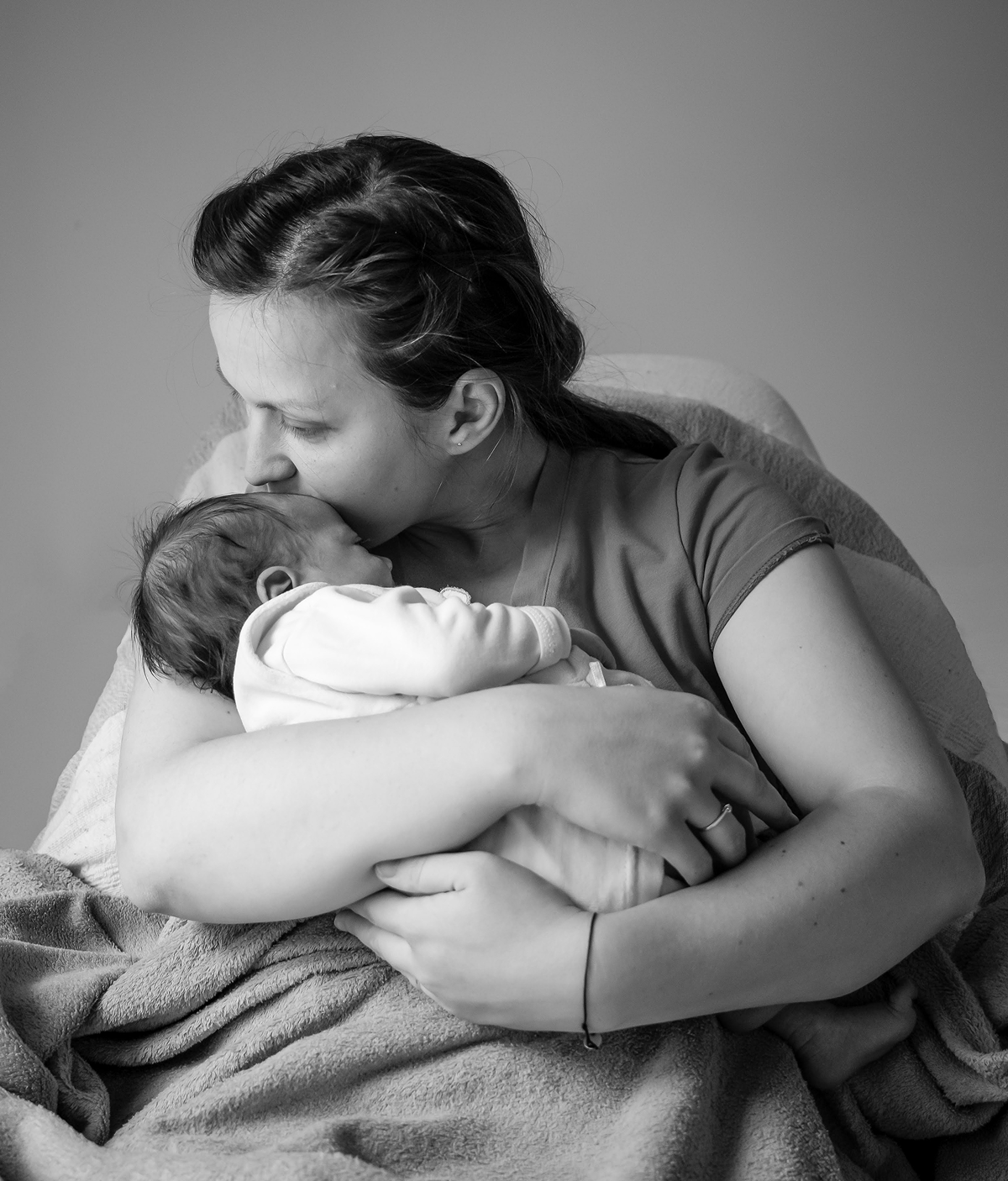A woman holds her baby with a cleft lip and palate, symbolizing patient empowerment and maternal love. 