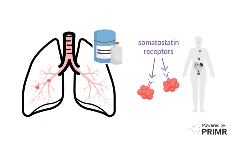 This image represents the thumbnail for the blog entitled A New Direction for Lung NETs: Exploring the Alliance Study and Lutetium Therapy.