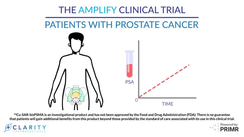 PRIMR | Prostate Cancer Radiation Simulation Procedure - Patient ...