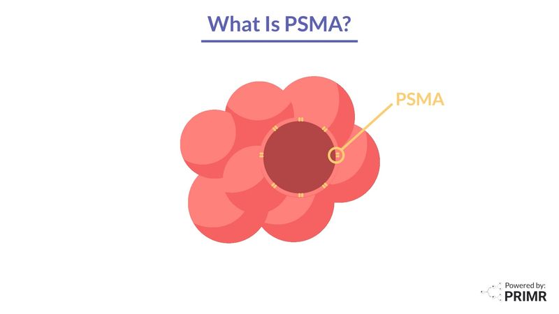 PRIMR | Prostate Cancer Radiation Simulation Procedure - Patient ...