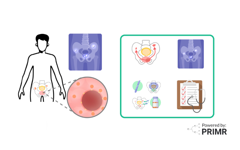 This image is the thumbnail for the blog titled Nuclear Medicine: PSMA Imaging and Its Impact on Prostate Cancer Care