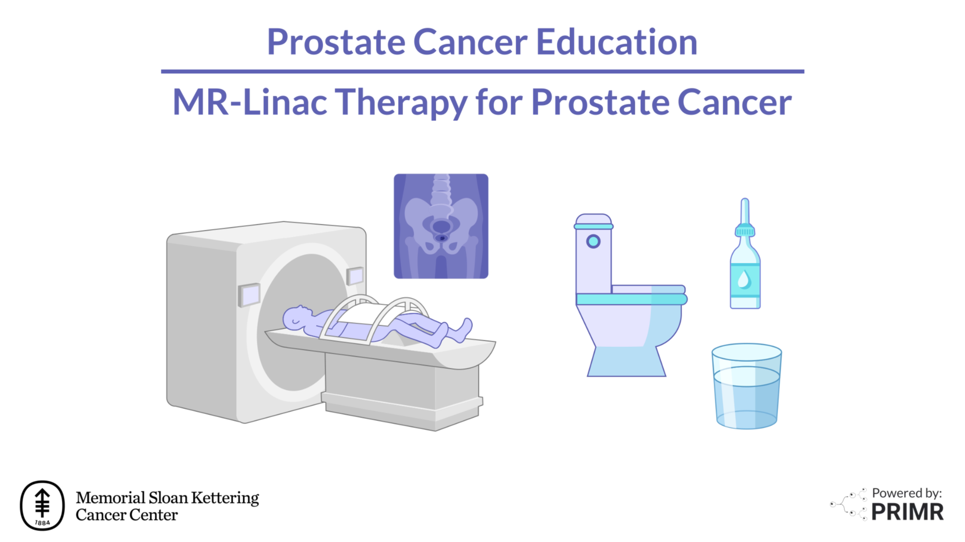 Patient receiving MR-Linac radiation therapy with daily MRI guidance for prostate cancer treatment