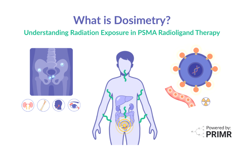 Simple guide to SBRT for prostate cancer patients and families