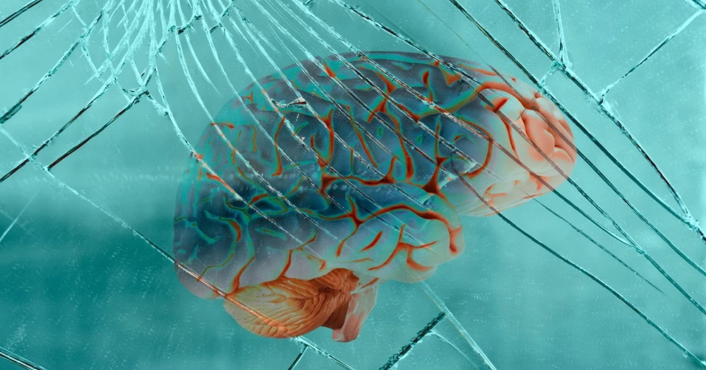 What Is a Traumatic Brain Injury?