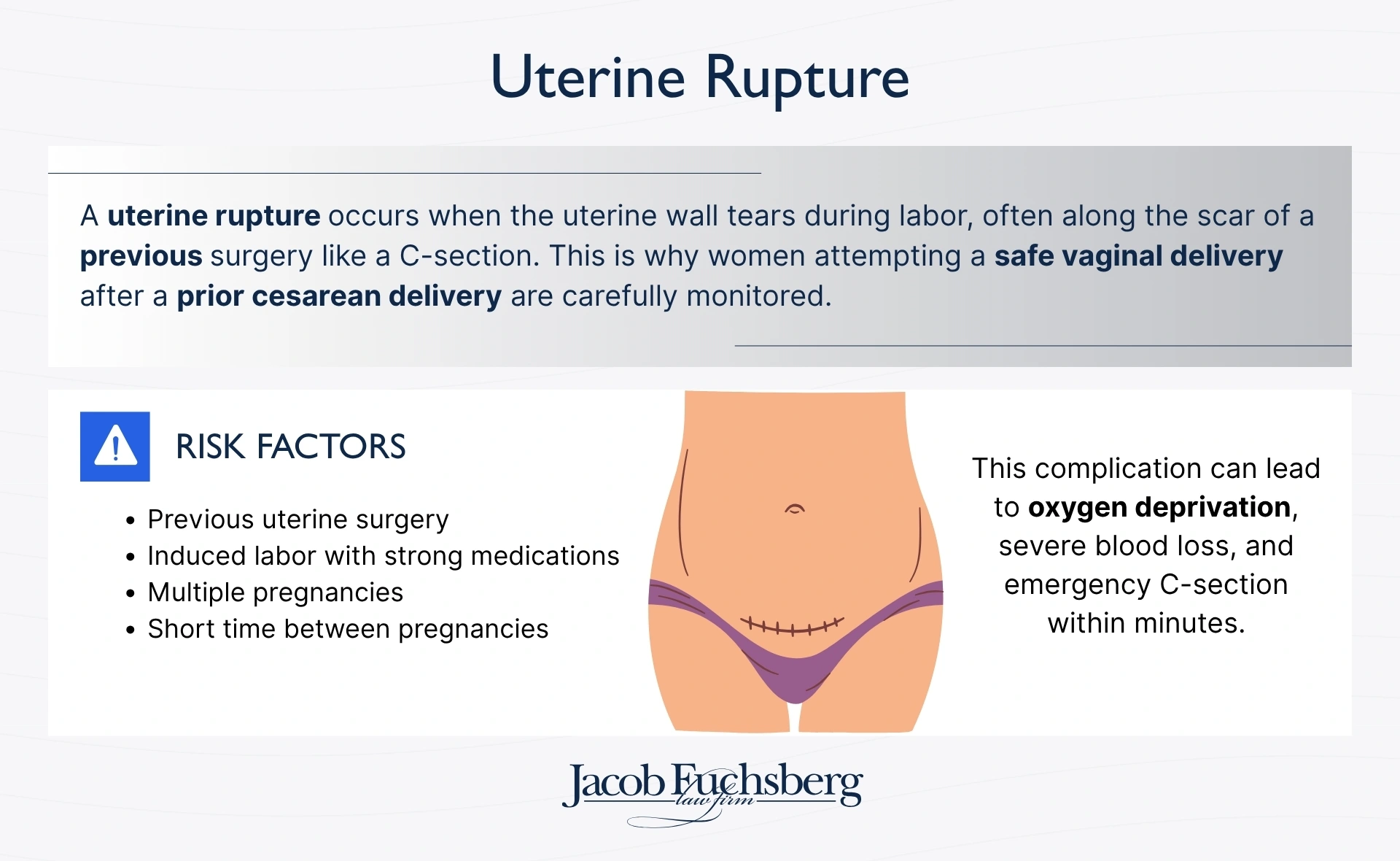 Uterine Rupture