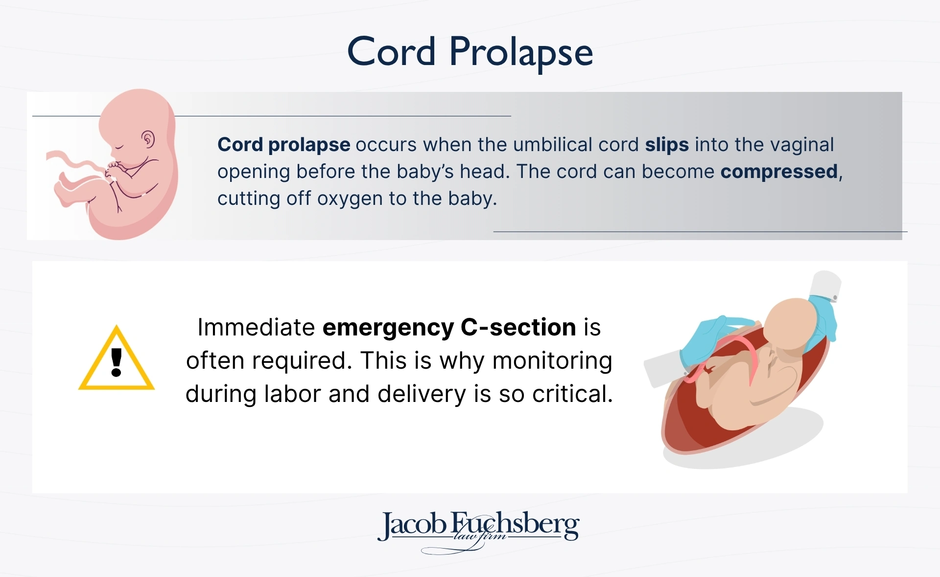 Cord Prolapse