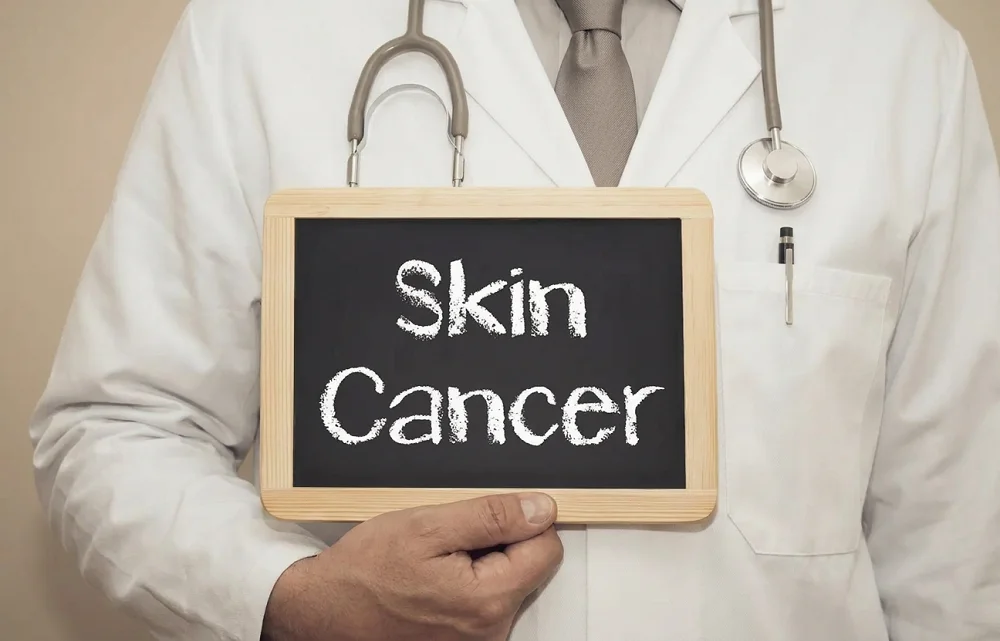Most Common Skin Cancer Misdiagnoses